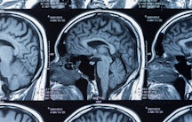 Gehirn Roentgen Symbolbild Medical Manager Berufsbild